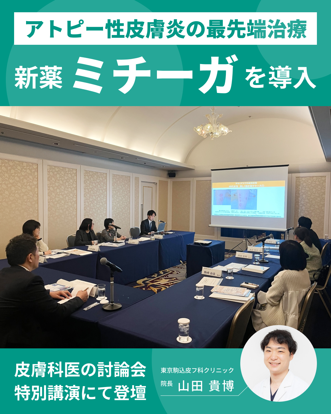 アトピー性皮膚炎の新しい治療選択