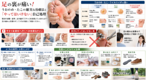 投稿についてもっと詳しく 足の裏が痛い！うおのめ・たこの確実な治療法と「やってはいけない」自己処理