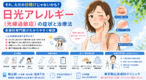 投稿についてもっと詳しく それ、ただの日焼けじゃないかも？日光アレルギー（光線過敏症）の症状と治療法を皮膚科専門医が解説