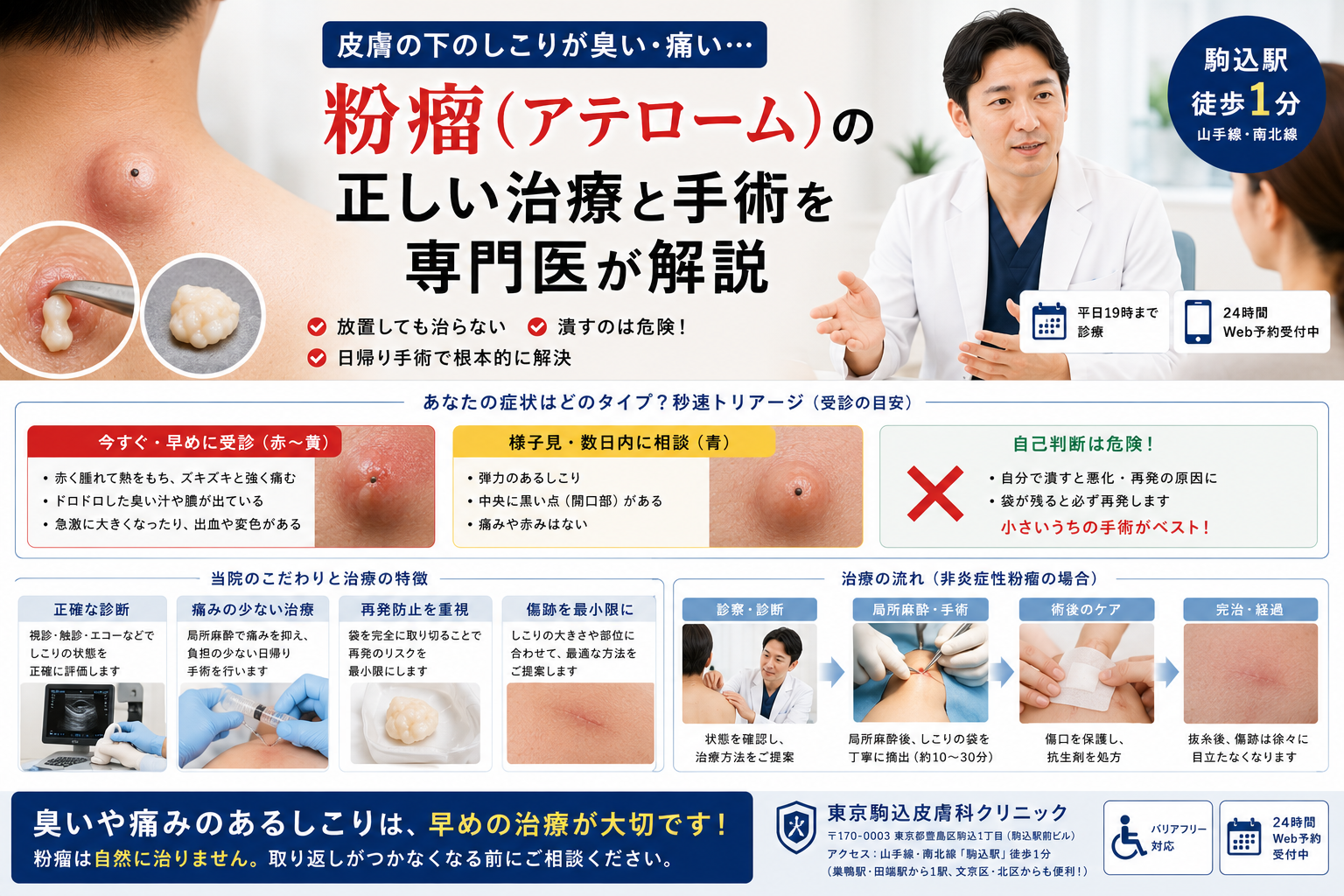 粉 瘤 臭い