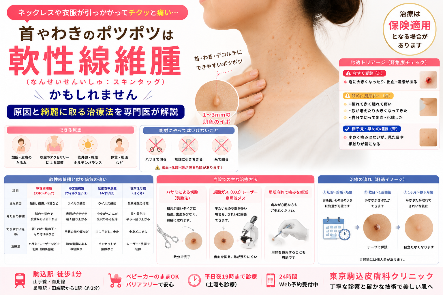 スキン タッグ 自分 で 取る