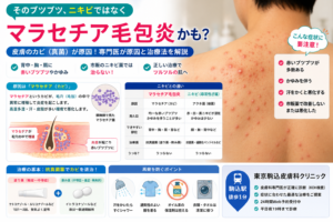 投稿についてもっと詳しく 背中や胸のブツブツはニキビじゃない？「マラセチア毛包炎」の原因と治療法を専門医が解説