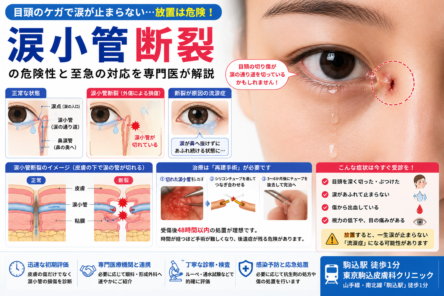 投稿についてもっと詳しく 目頭のケガで涙が止まらない…「涙小管断裂」の危険性と至急の対応を専門医が解説