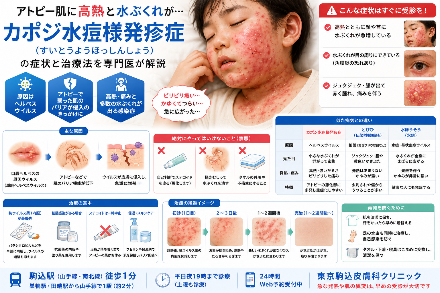 投稿についてもっと詳しく アトピー肌に高熱と水ぶくれが…「カポジ水痘様発疹症」の症状と治療法を専門医が解説