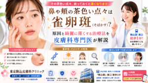 投稿についてもっと詳しく 鼻や頬の茶色い点々は「雀卵斑（そばかす）」？原因と綺麗に薄くする治療法を専門医が解説