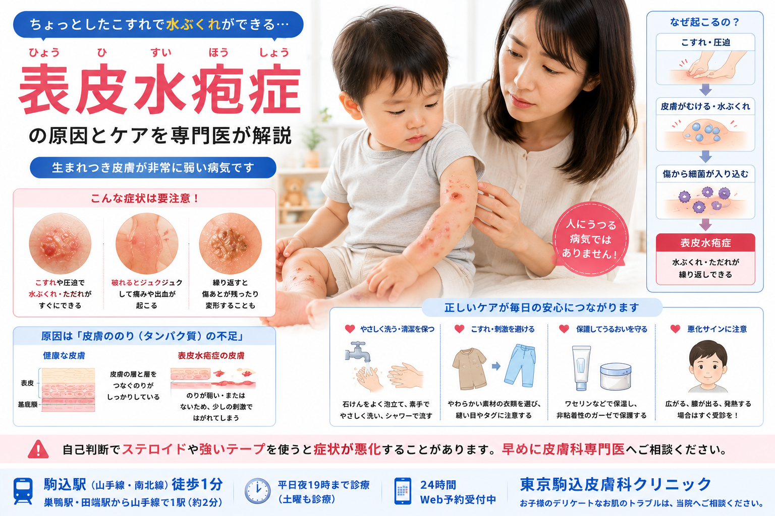 投稿についてもっと詳しく ちょっとしたこすれで水ぶくれができる…「表皮水疱症」の原因とケアを専門医が解説