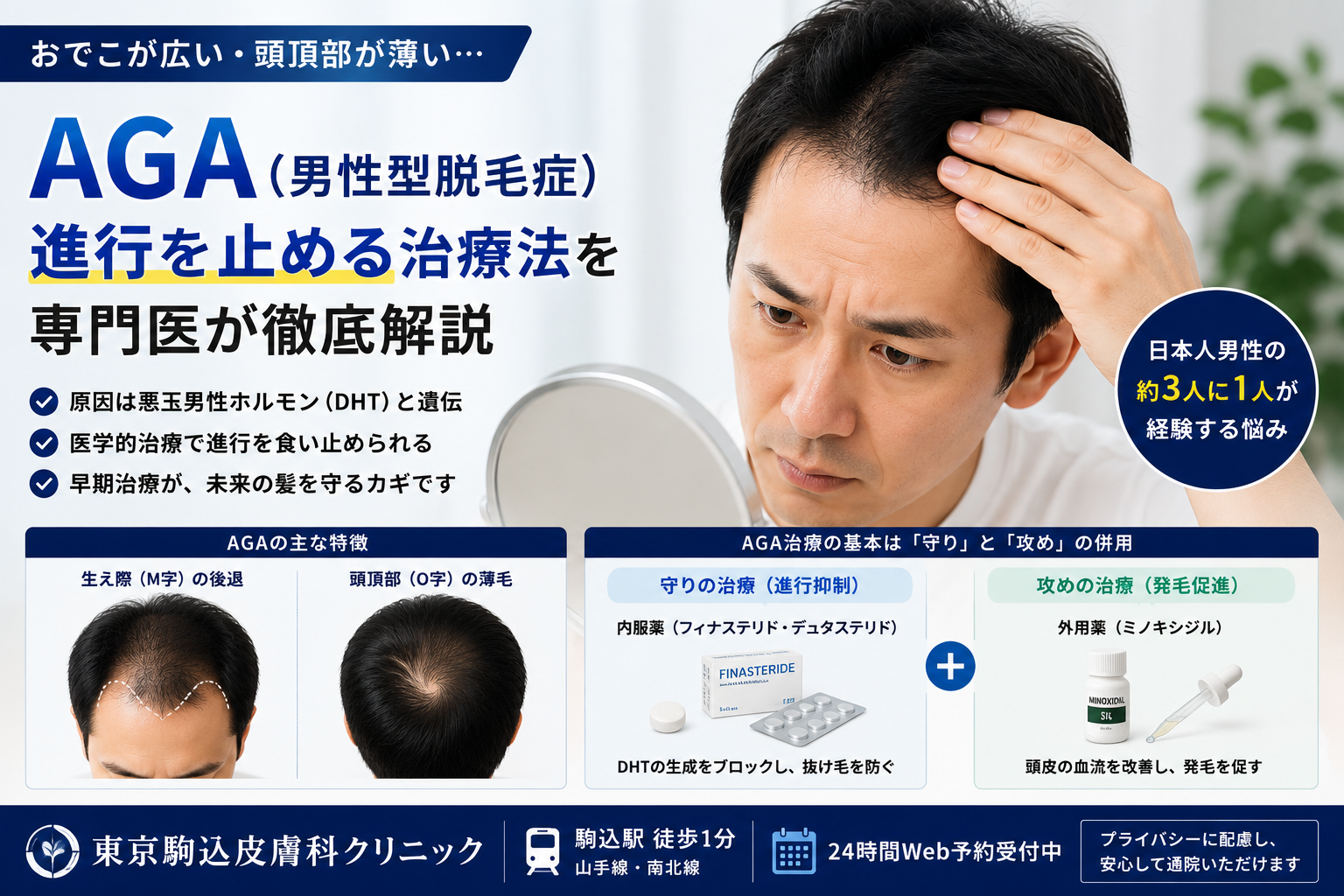 投稿についてもっと詳しく おでこが広い・頭頂部が薄い…「男性型脱毛症（AGA）」の進行を止める治療法を専門医が解説