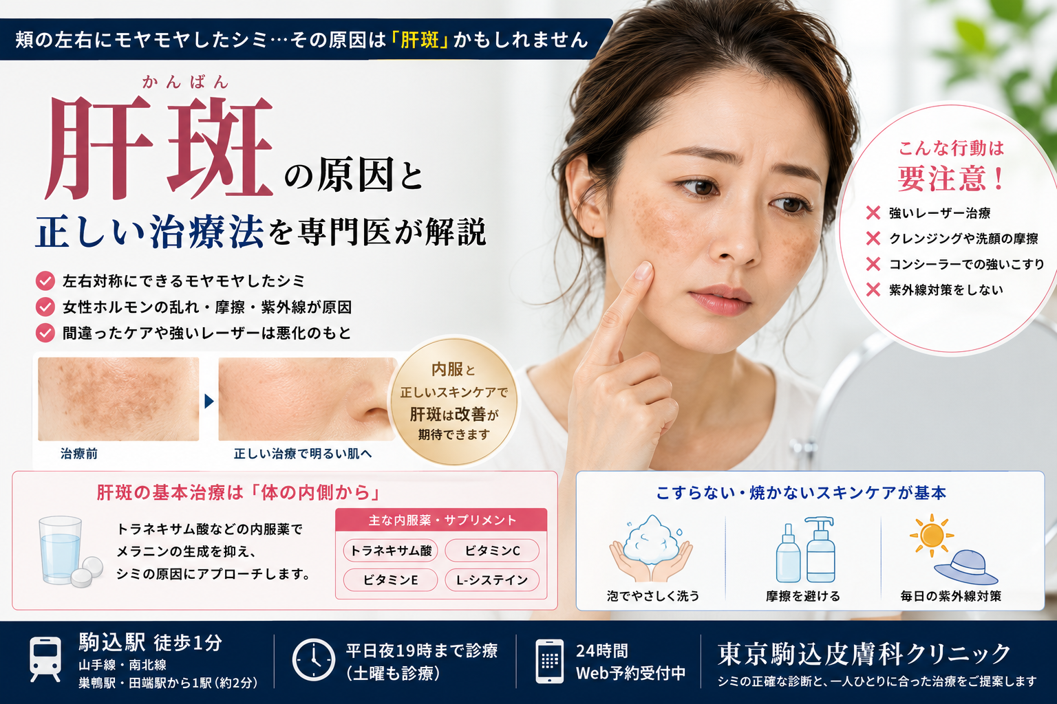 頬の左右にあるモヤモヤしたシミは「肝斑」？悪化させるNG行動と正しい治療法を専門医が解説