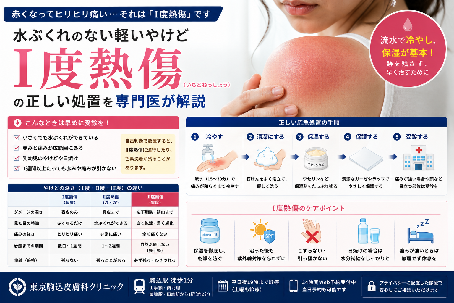 投稿についてもっと詳しく 赤くなってヒリヒリ痛い…水ぶくれのない「I度熱傷」の正しい処置を専門医が解説