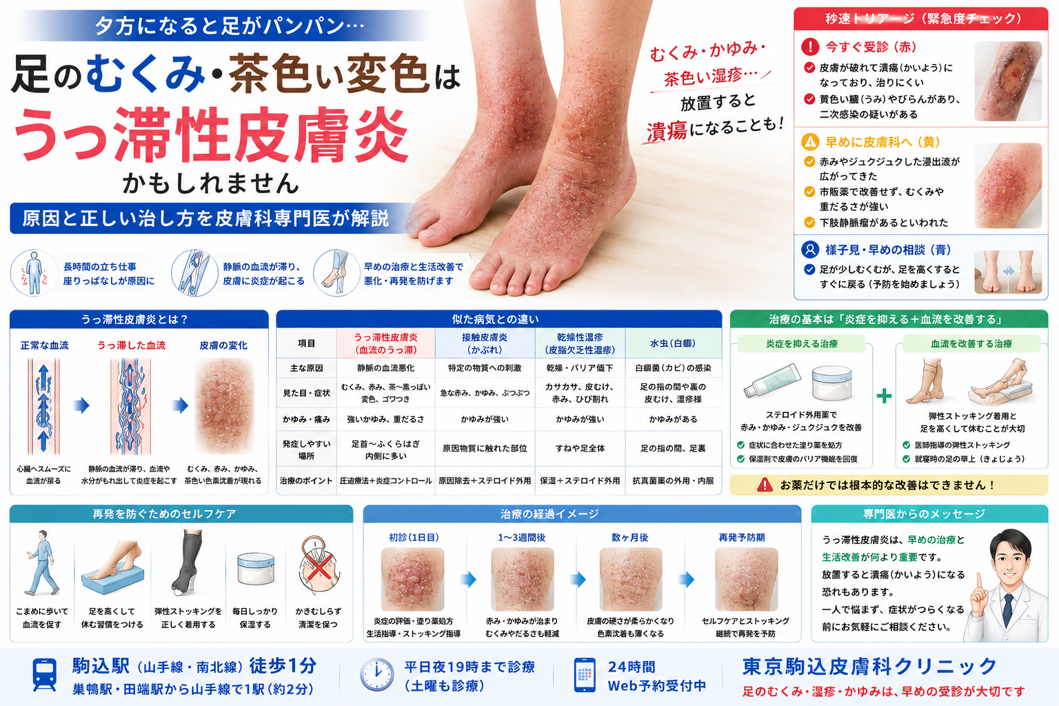 投稿についてもっと詳しく 足のむくみや茶色い変色は「うっ滞性皮膚炎」？原因と正しい治し方を専門医が解説