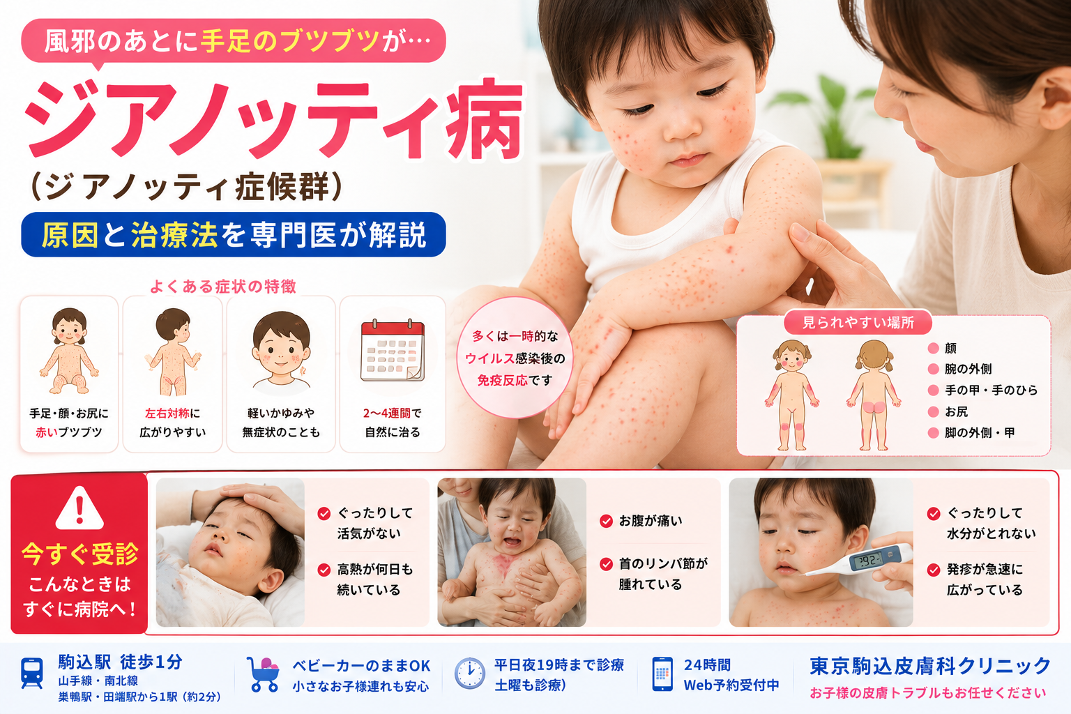 投稿についてもっと詳しく 風邪のあとに手足のブツブツが…「ジアノッティ病」の原因と治療法を専門医が解説
