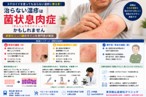 投稿についてもっと詳しく 治らない湿疹は「菌状息肉症（皮膚のリンパ腫）」かも？症状と治療法を専門医が解説