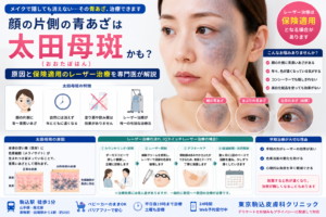投稿についてもっと詳しく 顔の片側の青あざは「太田母斑」？原因と保険適用のレーザー治療を専門医が解説