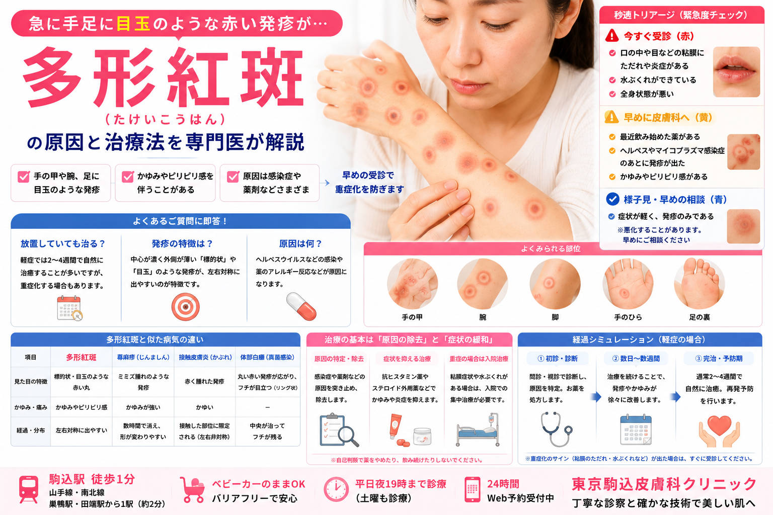 手足に目玉のような赤い発疹が…「多形紅斑」の原因と治療法を専門医が解説