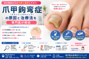 投稿についてもっと詳しく 足の親指の爪が分厚く変形…「爪甲鉤弯症」の原因とフットケア治療を専門医が解説