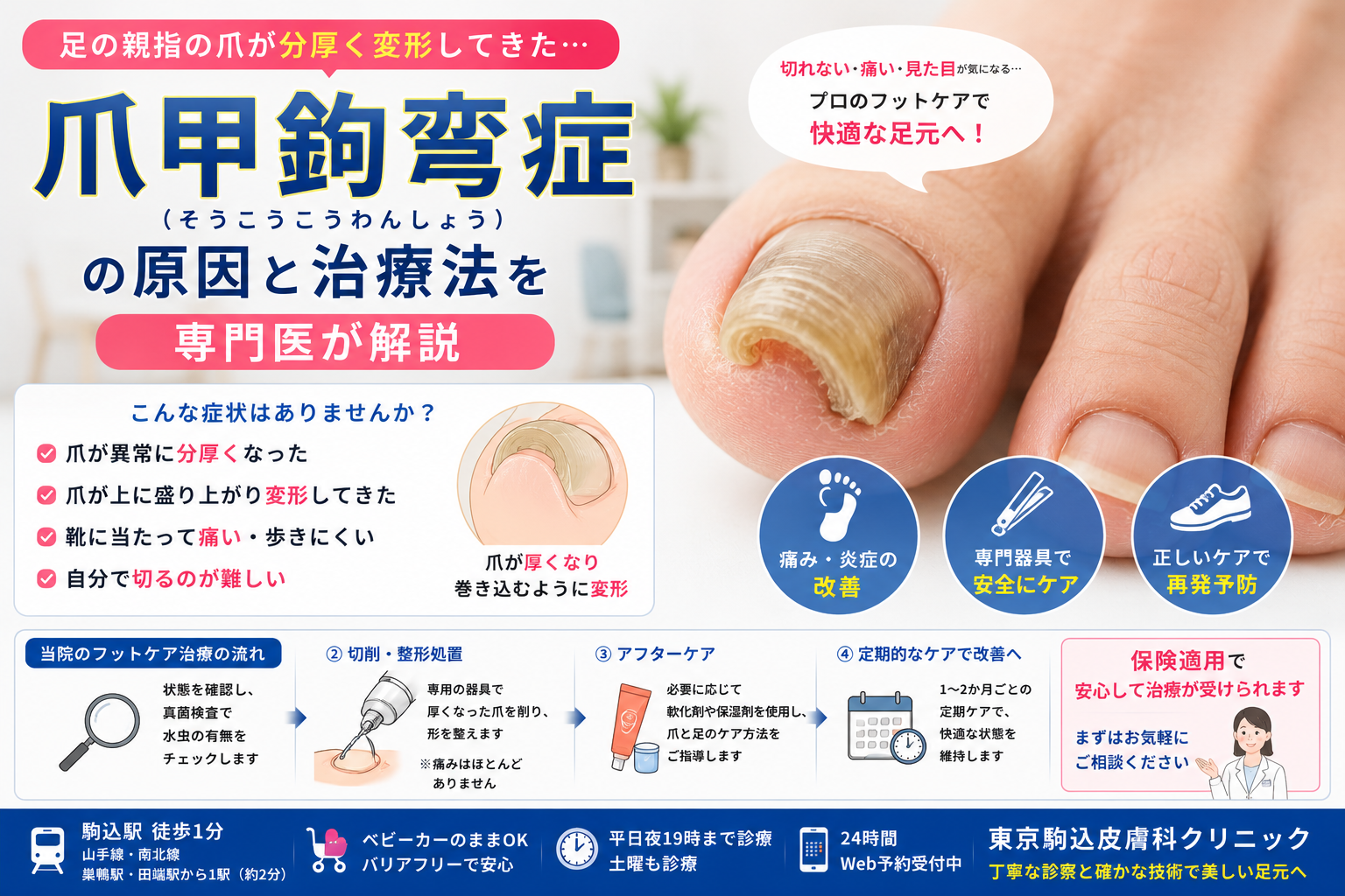 足の親指の爪が分厚く変形…「爪甲鉤弯症」の原因とフットケア治療を専門医が解説