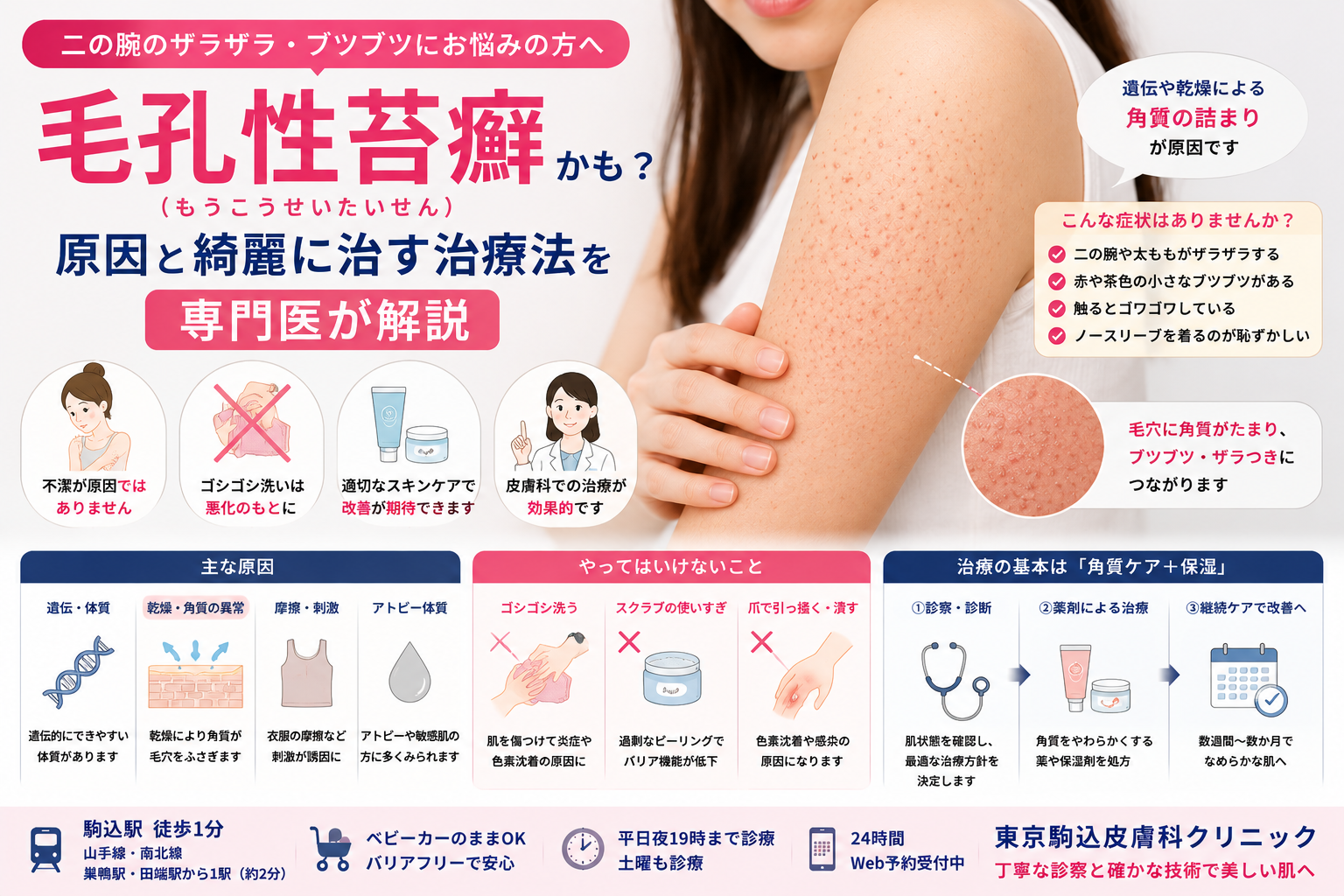 二の腕のザラザラ・ブツブツは「毛孔性苔癬」？原因と綺麗に治す治療法を専門医が解説