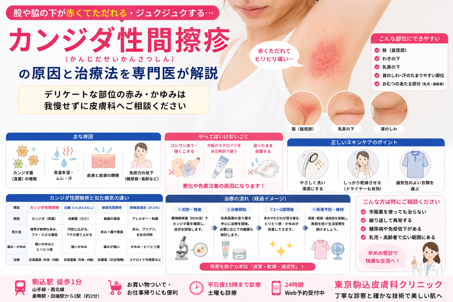 股や脇の下が赤くてただれる…「カンジダ性間擦疹」の原因と治療法を専門医が解説