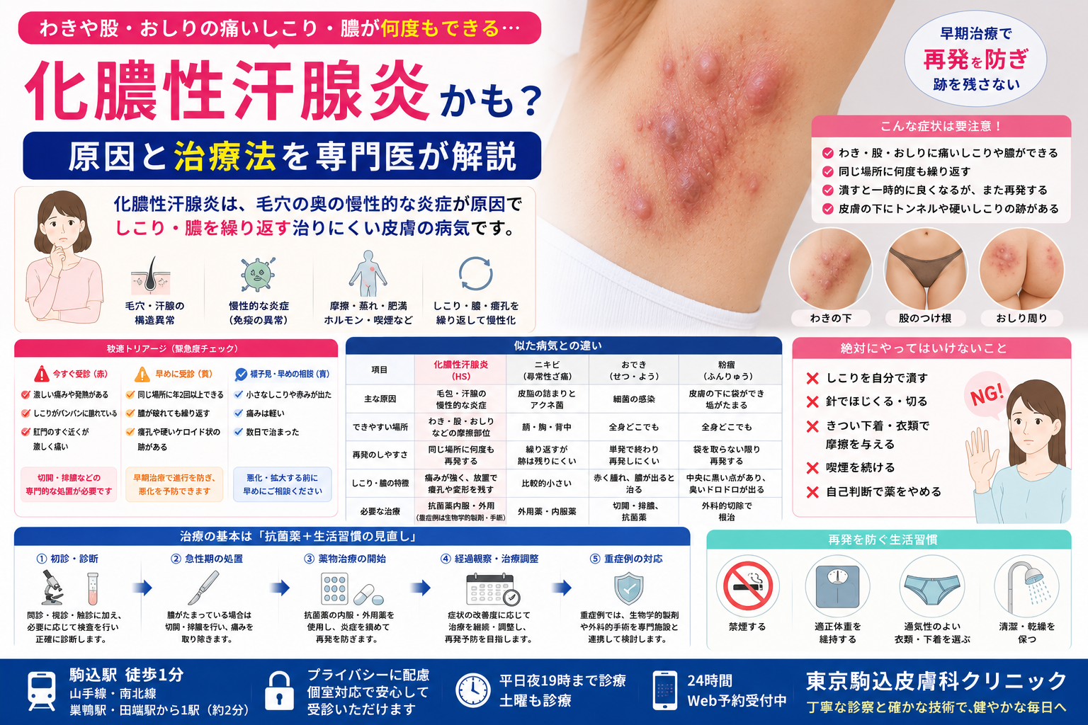 投稿についてもっと詳しく わきや股に何度もできる痛い「しこり・膿」はニキビではなく「化膿性汗腺炎」かも？