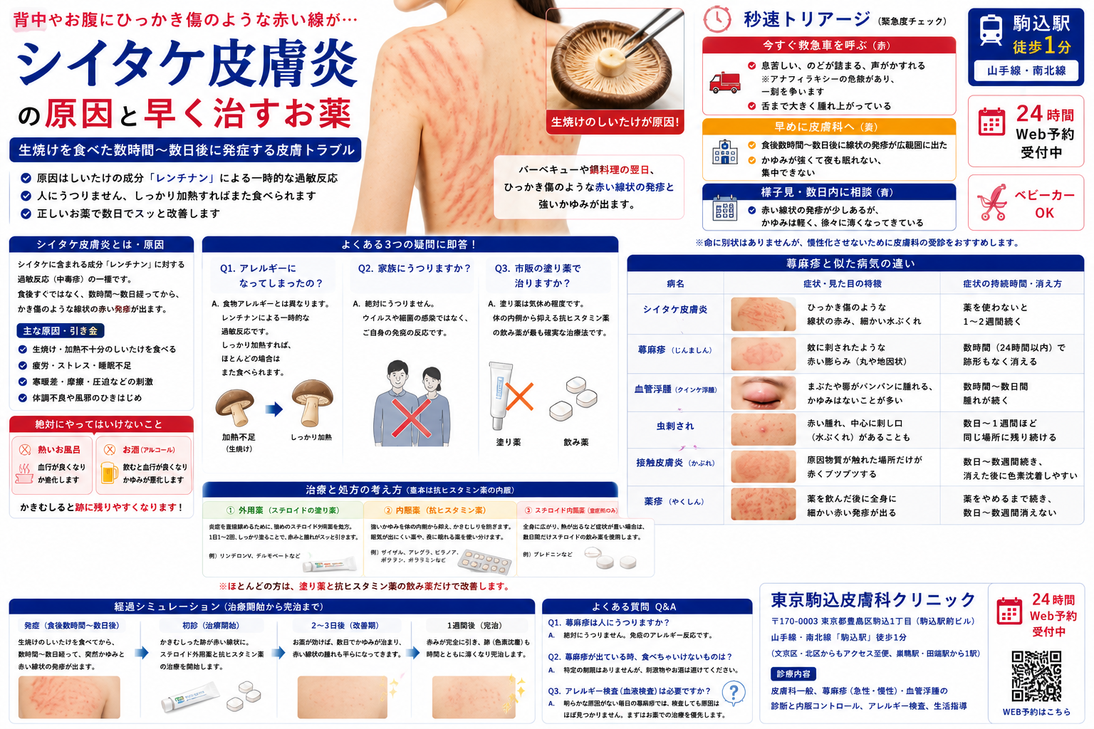 投稿についてもっと詳しく 背中やお腹にひっかき傷のような赤い線が…「シイタケ皮膚炎」の原因と早く治すお薬