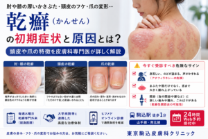 投稿についてもっと詳しく 乾癬（かんせん）の初期症状・原因とは？頭皮や爪の特徴を皮膚科専門医が解説