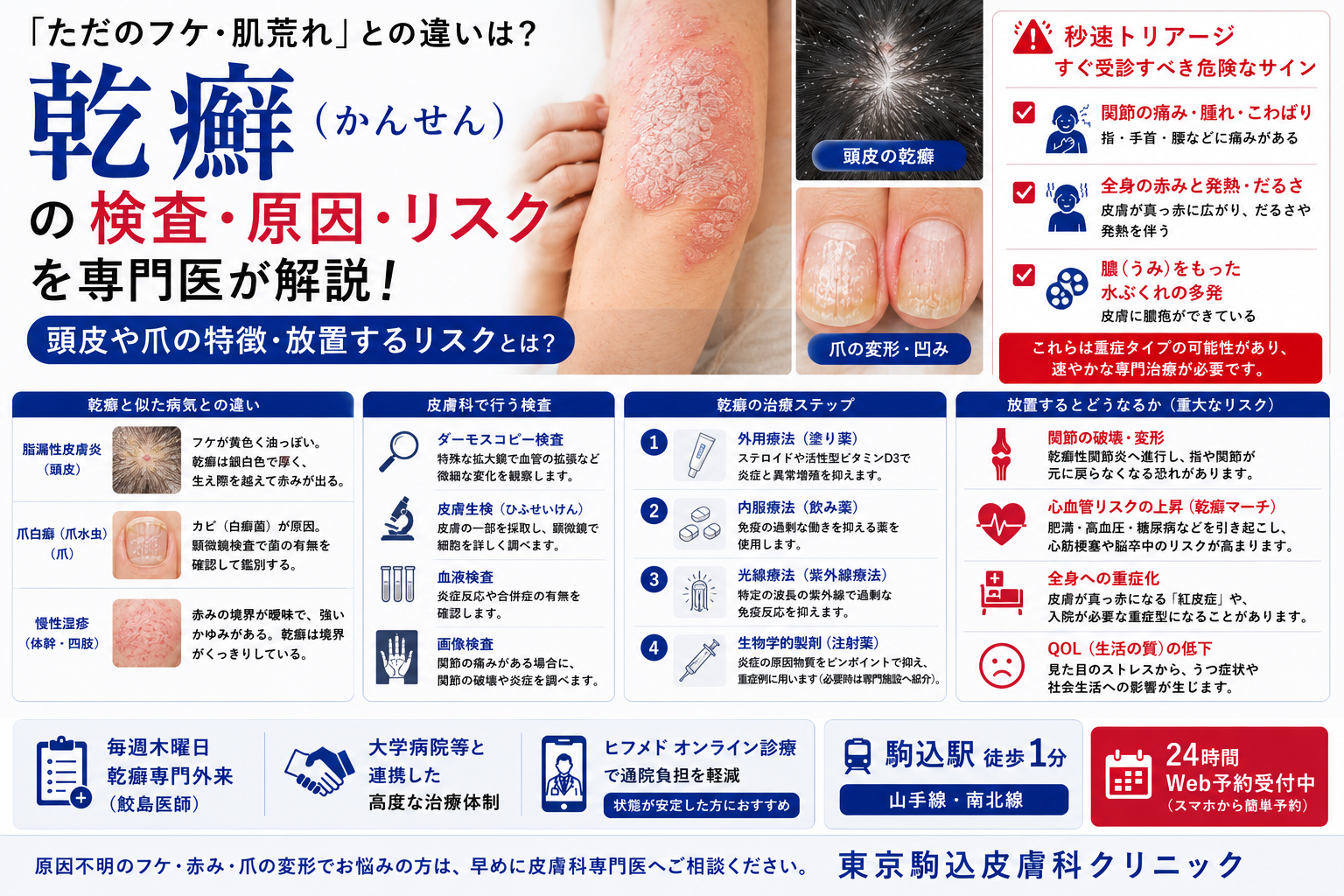 投稿についてもっと詳しく 「ただのフケ・肌荒れ」と乾癬の違いは？皮膚科の検査や放置するリスクを解説