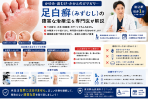 投稿についてもっと詳しく かゆみ・皮むけ・かかとのガサガサ…「足白癬（みずむし）」の確実な治療法を専門医が解説