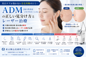投稿についてもっと詳しく 美白ケアが効かない左右対称のシミ…「ADM（後天性真皮メラノサイトーシス）」の正しい見分け方とレーザー治療