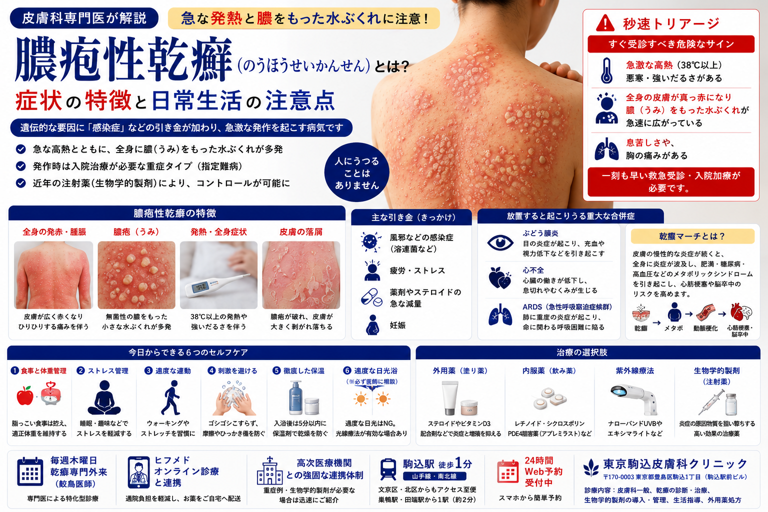 膿疱性乾癬（のうほうせいかんせん）とは？症状の特徴と日常生活の注意点