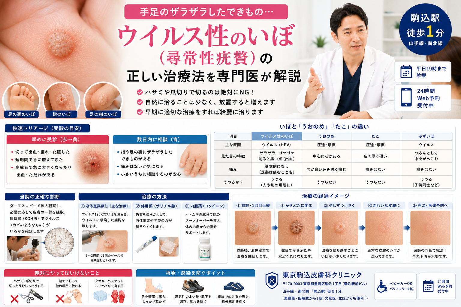 手足のザラザラしたできものは「ウイルス性のいぼ（尋常性疣贅）」？正しい治療法を専門医が解説