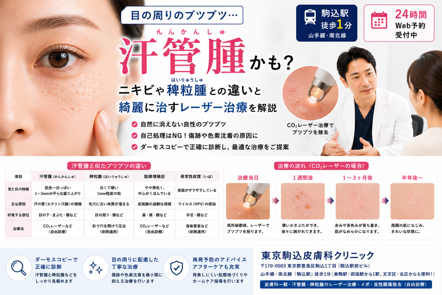 投稿についてもっと詳しく 目の周りのブツブツは「汗管腫」？ニキビや稗粒腫との違い・綺麗に治すレーザー治療を解説