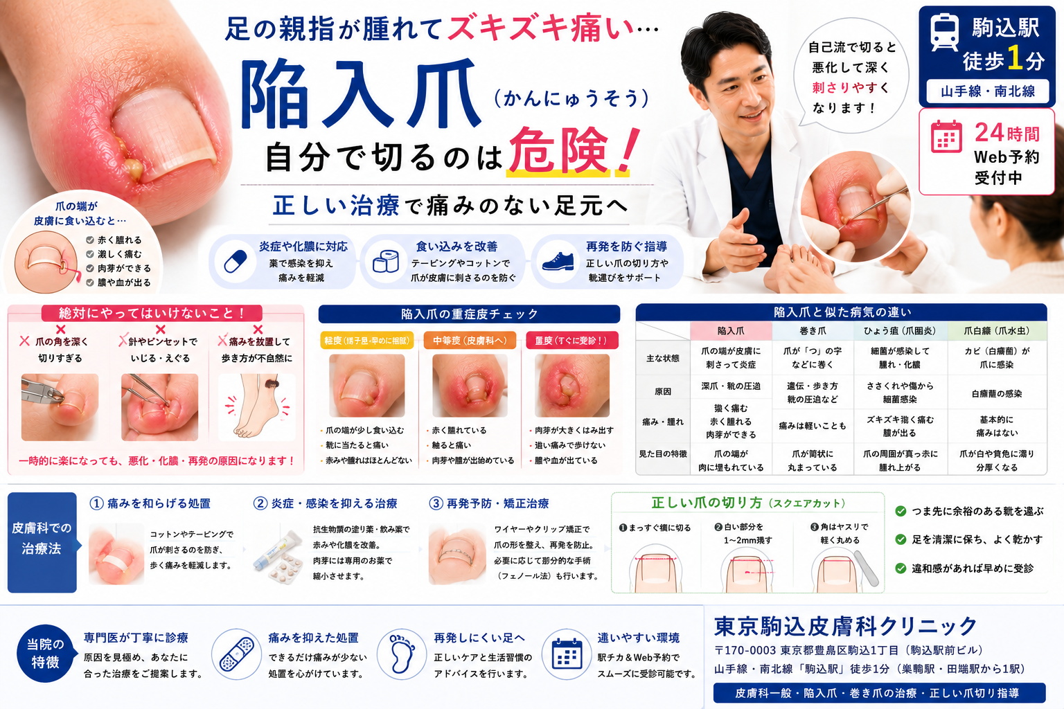 投稿についてもっと詳しく 足の親指が腫れて痛い…「陥入爪（かんにゅうそう）」を自分で切る危険性と皮膚科の治療法