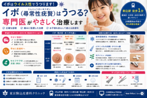 投稿についてもっと詳しく イボ（尋常性疣贅）はうつる？魚の目との違いや痛みに配慮した治療を専門医が解説