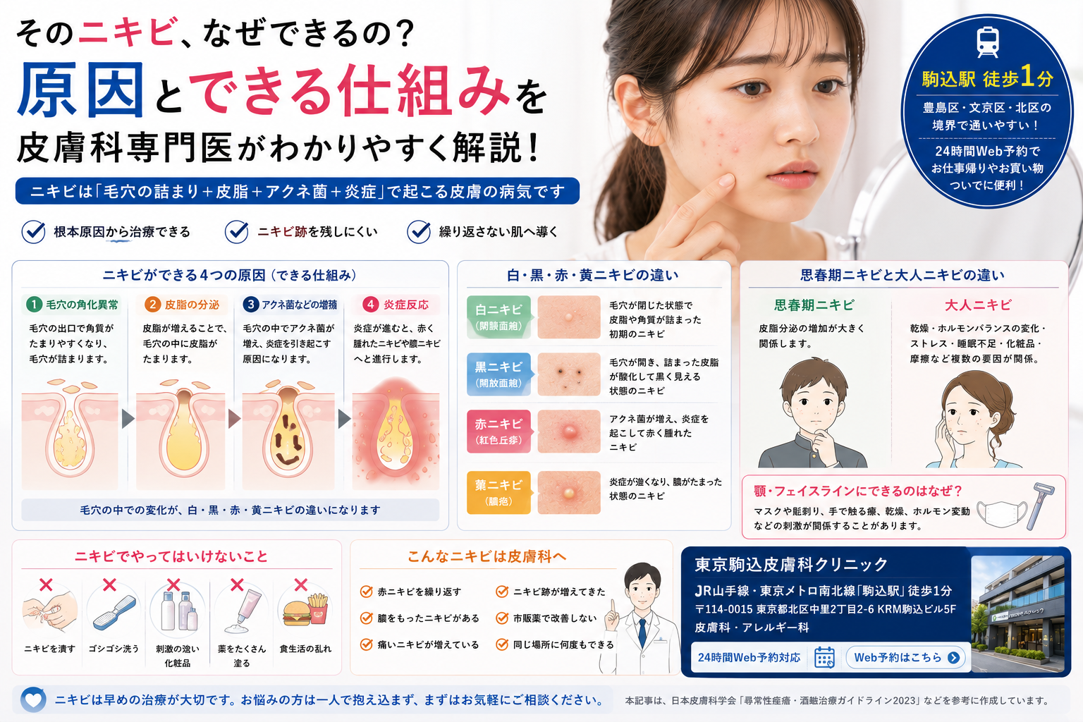 投稿についてもっと詳しく ニキビはなぜできる？原因とできる仕組みを皮膚科専門医が解説